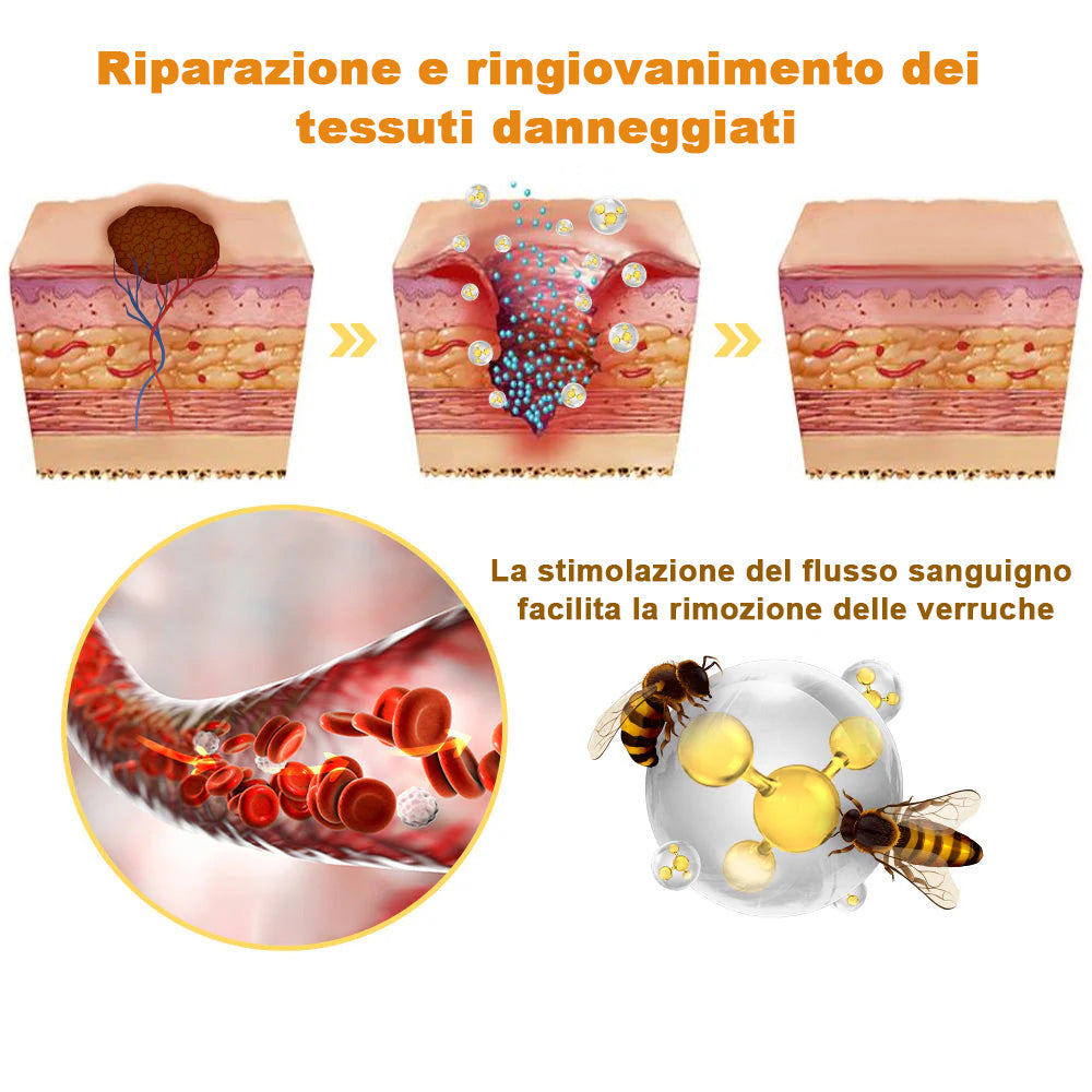 🌼🌼[💦Negozio ufficiale del marchio💦] Zoencgz™ Crema trattante al veleno d'api e verruche（👨‍⚕EMA Certificazione）