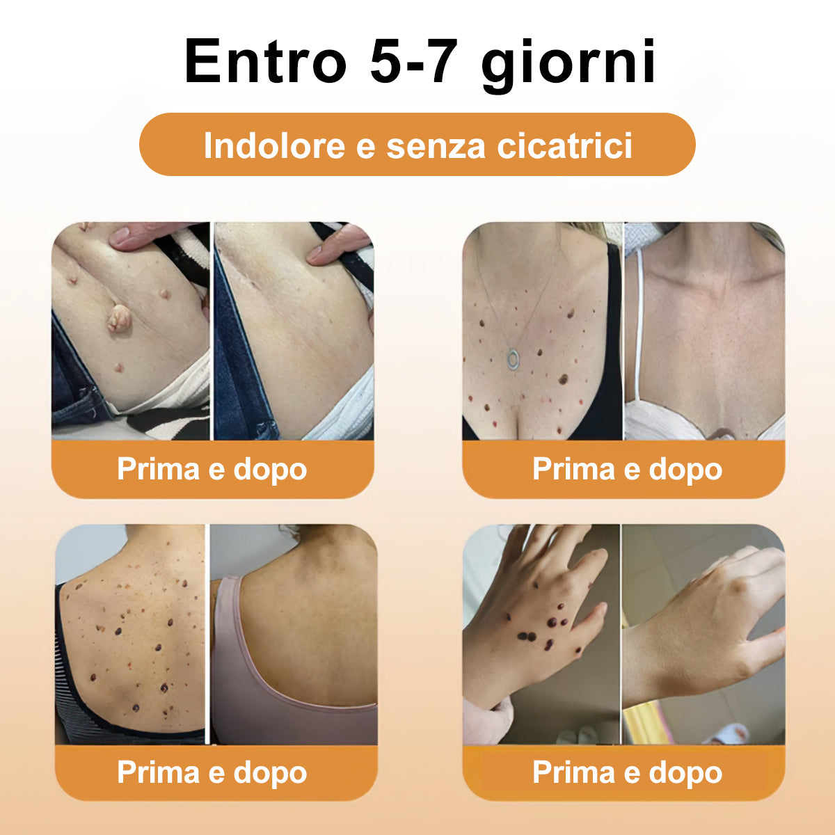 🌼🌼[💦Negozio ufficiale del marchio💦] Zoencgz™ Crema trattante al veleno d'api e verruche（👨‍⚕EMA Certificazione）