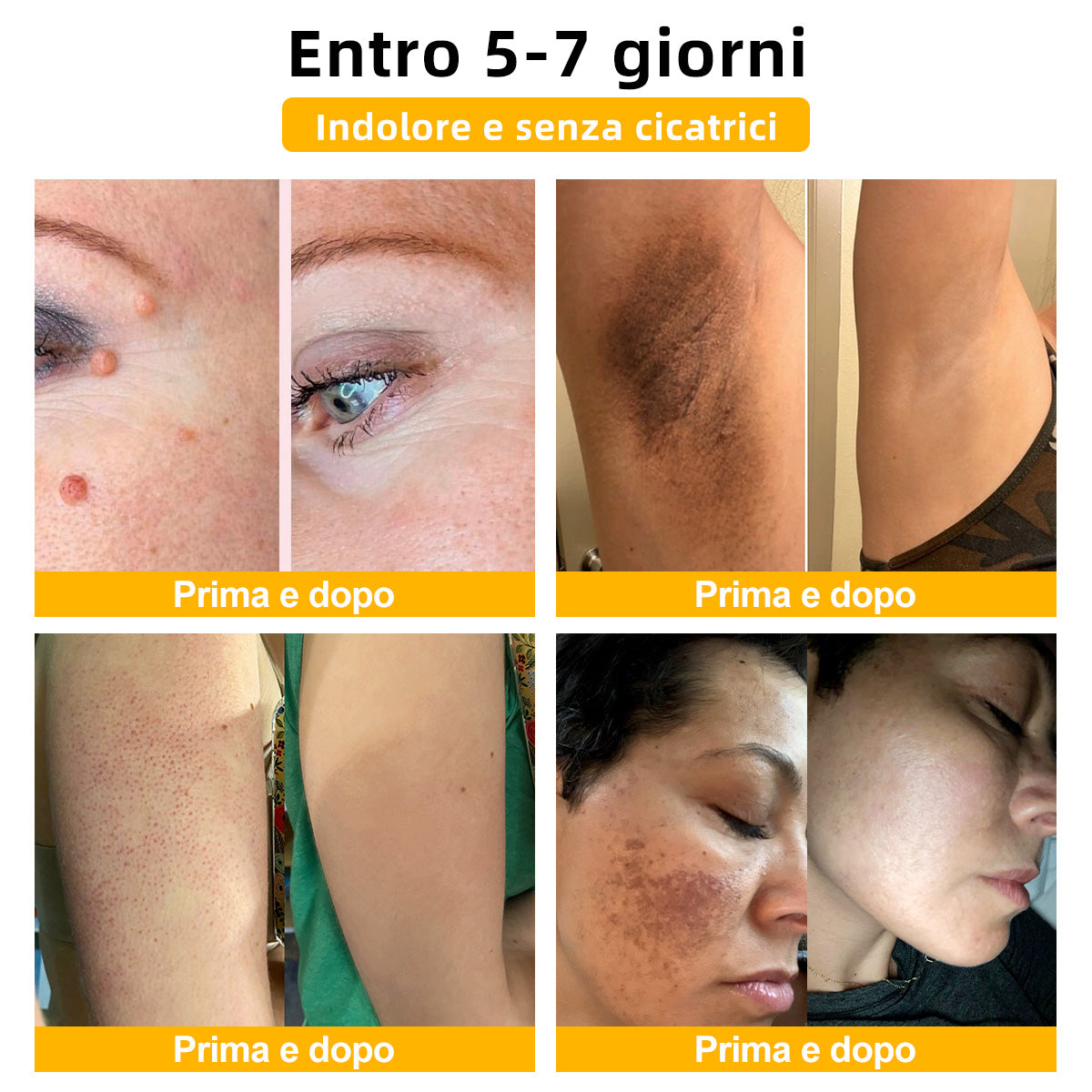 🌼🌼[💦Negozio ufficiale del marchio💦] Zoencgz™ Crema trattante al veleno d'api e verruche（👨‍⚕EMA Certificazione）