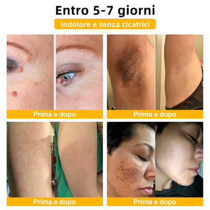 🌼🌼[💦Negozio ufficiale del marchio💦] Zoencgz™ Crema trattante al veleno d'api e verruche（👨‍⚕EMA Certificazione）